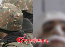 ՏԵՍԱՆՅՈՒԹ․ Դաժան ծեծի ենթարկված զինվորի աչքերը լուրջ վնասվել են, չի բացառվում՝ հեռացնեն․ կատարողները չկան